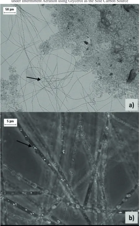 Figure 5.  Optical microscopy images in a second operational phase. a) Filamentous bacteria; b) Beggiatoa highlighting the elemental sulfur  granules.