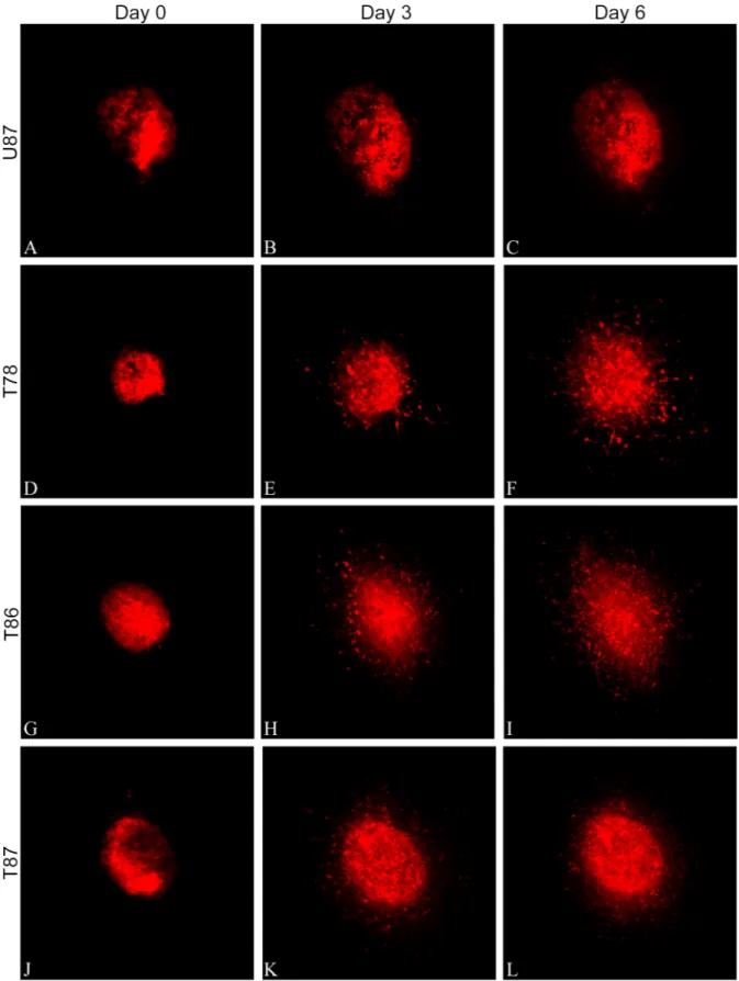 Fig 2. Confocal images of spheroid invasion. Confocal z-stacks were recorded on day 0, one hour after implantation of DiI- DiI-labeled spheroids into the brain slice cultures and after 3 and 6 days