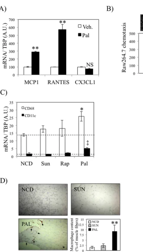 Figure 4. Palmitate induces macrophages recruitment by C 2 C 12 muscle cells. A) C 2 C 12 differentiated myotubes were exposed to palmitate (pal, 500 mM) or vehicle (BSA) for 24 hours