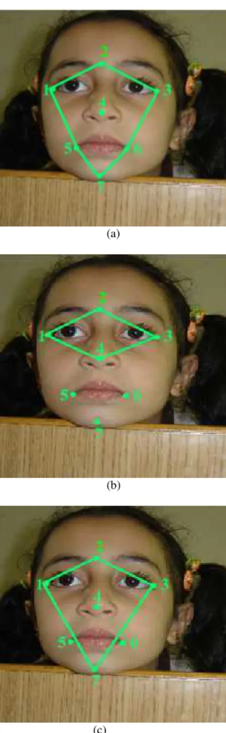 Fig. 6:  Three  dimensional  Measurements  according  to  Angles 