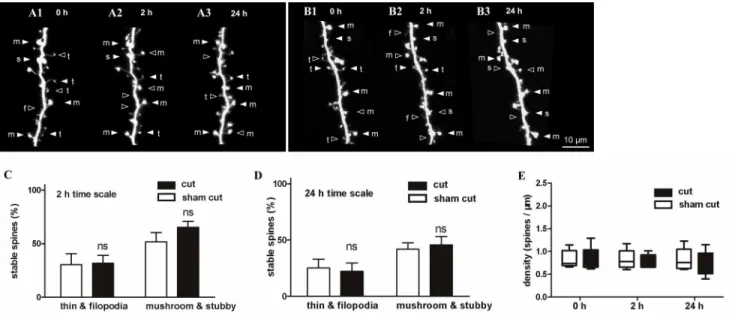 Fig 6. Stability of dendritic spines after olfactory nerve severance. (A, B) Serial time-lapse images showing the morphology of dendritic spines in the sham group (A) and olfactory nerve severance group (B) imaged at 0 h, 4 h, and 24 h, respectively, after