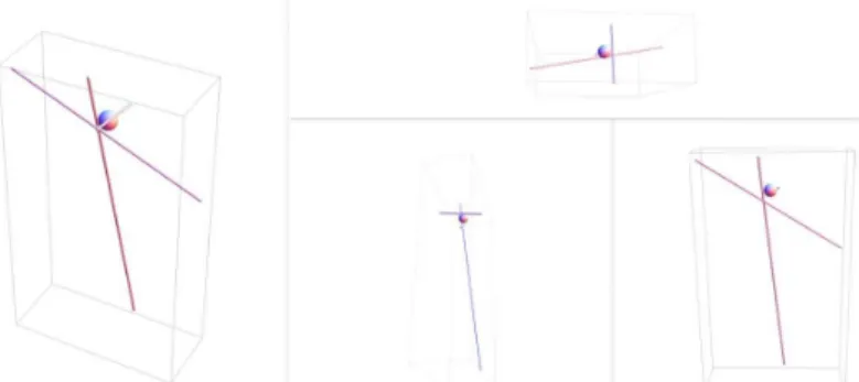 Figure 15: The resistance axes (model with softened tooth and stiffened bone and PDL)