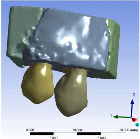 Figure 5: Structural model in ANSYS. 