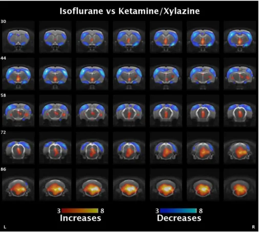 Figure 6. Representative rat brain images obtained by statistical parametric mapping of the standardized uptake values to compare rats kept under  isoflurane and ketamine/xylazine anaesthesia during the 2-deoxy-2-[ 18 F]fluoroglucose uptake period