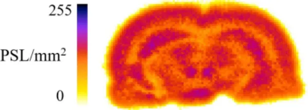 Figure 1. Coronal section of ex vivo autoradiography of the rat brain  1 h after intravenous injection of 37 MBq 2-deoxy-2-[ 18 F]fluoroglucose; 