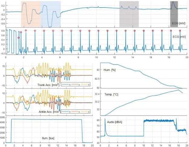 Figure 4. Result of one bench test. The light red and blue zones in the EOG graph indicate execution of the first and second eye movement cycles, the  light grey zone indicates the natural eye blink and the dark grey zone indicates the forceful blink
