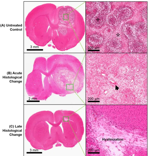 Figure 2. Histological examples of stereotactic radiosurgery (SRS) effects. Representative Hematoxylin &amp; Eosin images of (A) an untreated control, (B) acute histological change at 4 days post-SRS, and (C) late histological change at 59 days post-SRS