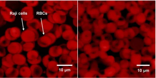 Figure 2. Atomic force microscope-scanned images of Raji cells and RBCs.