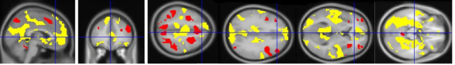 Figure 1. TPN (red) and DMN (yellow) masks derived from 3vs0 contrast task-related activation and deactivation respectively of HC (corrected for multiple comparisons, p = 0.05, presented in neurological convention).