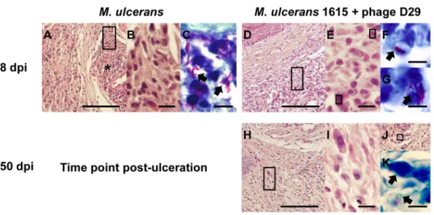 Figure 4. Histology of mice footpads of non-treated mice or mycobacteriophage D29-treated mice
