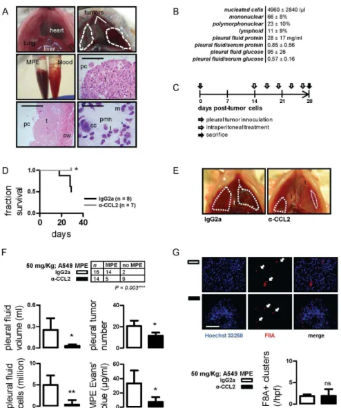 Figure 6. CCL2 blockade limits MPE induced by A549 human lung adenocarcinoma. (A) Development of a novel model of MPE induced by A549 cells