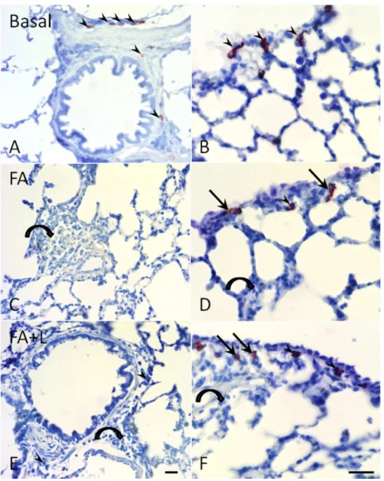 Fig 5. Treatment with LLLT increases IL-10 gene expression and did not alter IL-6 gene expression in the lung tissue after FA exposure