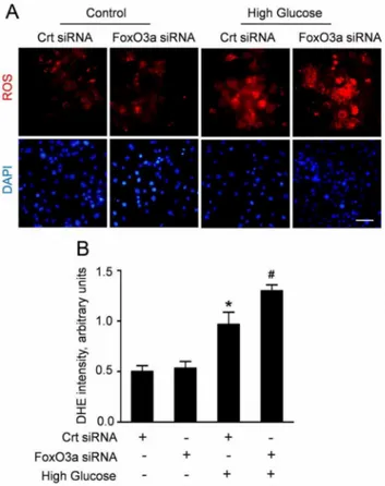 Figure 4. FoxO3a silencing enhanced high glucose-induced ROS production in CMECs. A: Representative immunofluorescence staining for subcellular localization of FoxO3a (green fluorescent) in CMECs under high glucose condition for the indicated time points (