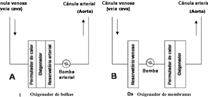 Figura  1.  Diagrama  que  ilustra  o  modelo  geral  dos  circuitos  de  circulação  extracorpórea  com  oxigenadores de bolha (A) e com oxigenadores de membrana (B)
