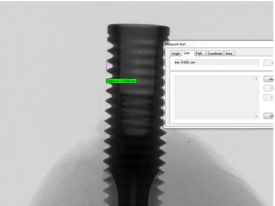 Figure 3: Micro-CT constructed image and measure tool utilization. 