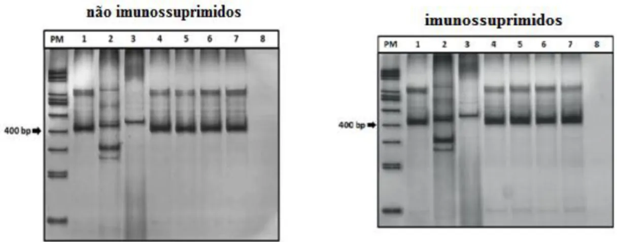 Fig.  3.  Perfis  eletroforéticos  obtidos  por  PCR  de  amostras  de  fezes  de  ratos  não  imunossuprimidos  e  imunossuprimidos  infectados  por  S