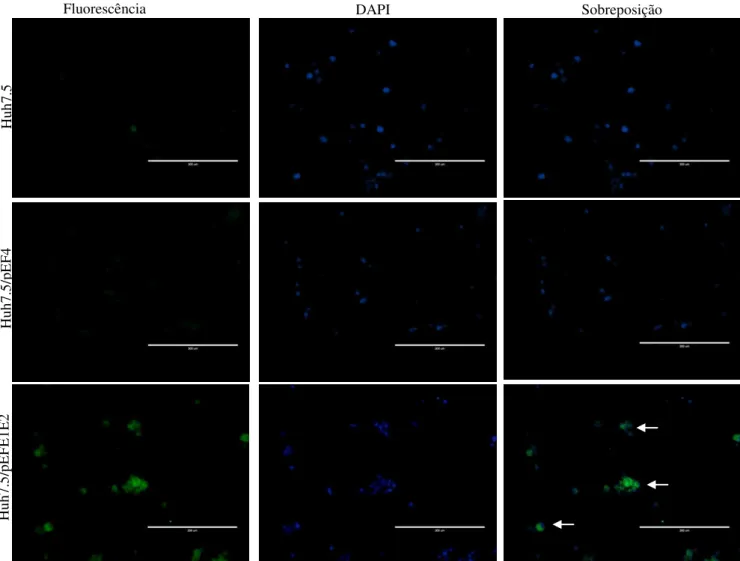 Figura  7.  Reação  de  imunofluorescência  indireta  utilizando  o  mAb  anti-6xHis  e  células  Huh7.5/pEFE1E2