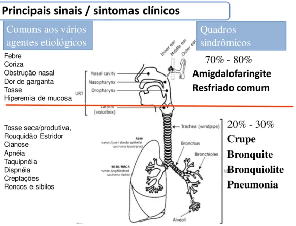 Figura 1 – Sinais e sintomas das IRAs e principais e síndromes clínicas 