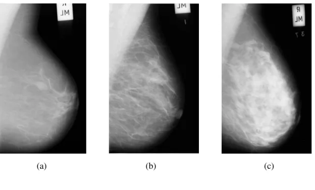 Figura 5.2  – Banco mini-MIAS: exemplo de imagens pré-processadas das três classes  de densidade mamária