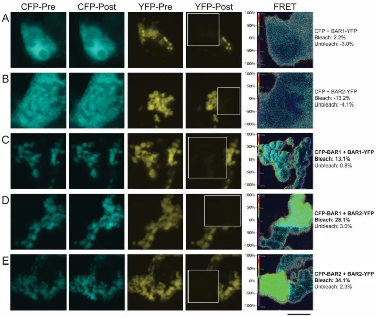 Figure 4. Cell images from standard acceptor photobleaching experiments. Shown are representative cells corresponding to two control FRET pairs: (A) CFP + BAR1-YFP and (B) CFP + BAR2-YFP, and three experimental FRET pairs: (C) CFP-BAR1 + BAR1-YFP, (D) CFP-