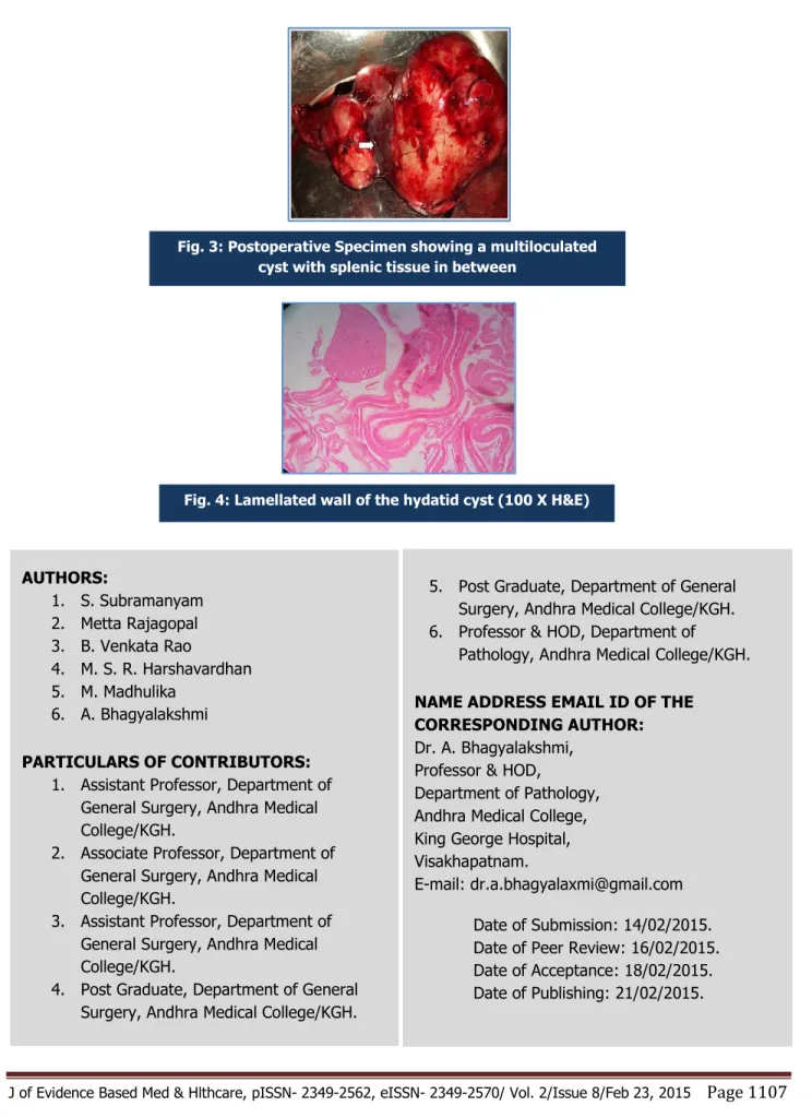 Fig. 3: Postoperative Specimen showing a multiloculated  cyst with splenic tissue in between 