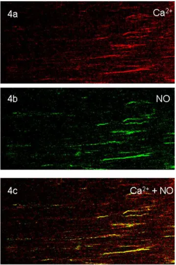 Figure 4. Colocalization NO signals with nNOS immunoreactive varicosities. In this experiment the muscle strip that was preloaded with DAF-2 under NANC conditions, applied EFS and then fixed was immunostained with anti-nNOS antibody