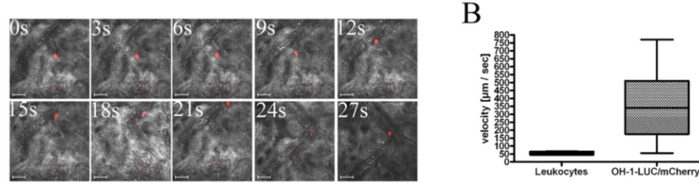 Figure 4. SCLC cell line OH-1 spontaneously metastasizes to lung and bone in immunodeficient mice
