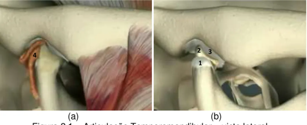 Figura 2.1 – Articulação Temporomandibular – vista lateral.  