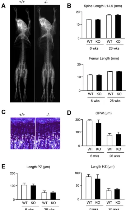Fig 2. Intact skeletal growth in Thbs4-deficient mice. (A) Xray analysis demonstrates absence of gross skeletal abnormalities in 6 weeks old Thbs4-deficient mice