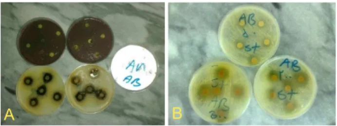 Figure 2. Effect of Artemisia absinthium on (A) Haemophilus  inluenza  and (B) Staphylococcus aureus.