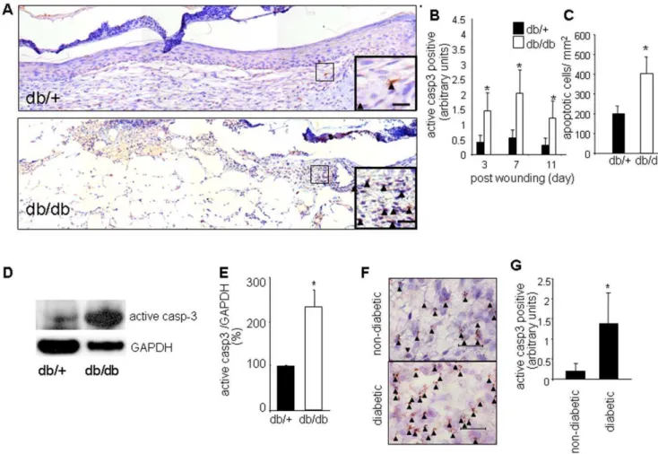 Figure 1. Increased number of apoptotic cells in wounds of diabetic mice and humans. A, Representative mosaic images from day 3 wounds of diabetic (db/db) or non-diabetic (db/+) mice stained with active caspase 3 (brown)