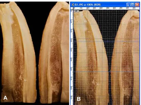 Figura 4: Caso 2 (G1) A. dente seccionado evidenciando a luz do canal; B. sobreposição da  grade na imagem do dente seccionado e divisão da raiz em terços .