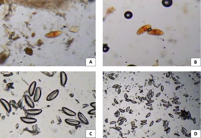 Figura  3.  Ovos  de  Syphacia  muris  detectados  pelos  métodos  de  sedimentação,  (A),  Willis  (B), Graham (C) 100x e Graham (D) 40x