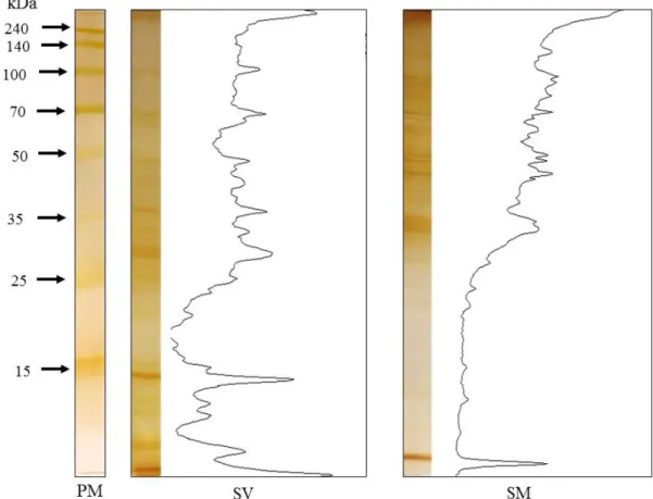 Figura  4.  P erfil  eletroforético  em  SDS – PAGE  12%  dos  extratos  salinos  total  de  larvas  filarioides de Strongyloides venezuelensis e adultos de Syphacia muris