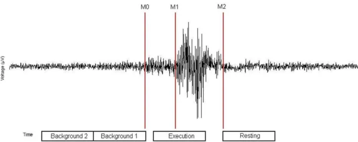 Figure 2. Definition of active and resting stage of swallowing-related muscle activity