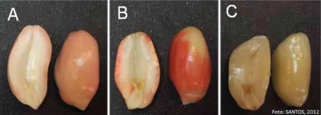 Figura 4. Classificação de sementes de amendoim utilizada para ambos os cultivares,  no entanto, exemplificada para o cv