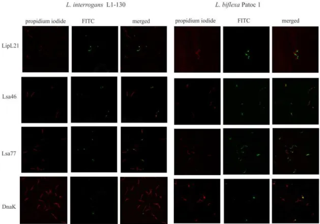Fig 3. Cellular localization of native proteins in Leptospira. Virulent L. interrogans serovar Copenhageni strain FIOCRUZ L1-130 (left panel) and saprophyte L