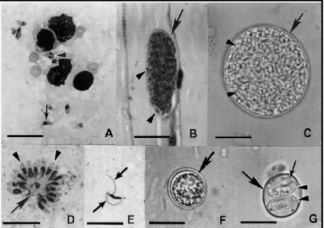 Figura 2. Estágios morfológicos de T. gondii.  (A) Taquizoítas circulantes. As setas  apontam taquizoítas individuais em forma de crescente, enquanto as cabeças de seta  apontam taquizoítas em divisão; (B) Cistos teciduais em corte de músculo esquelético