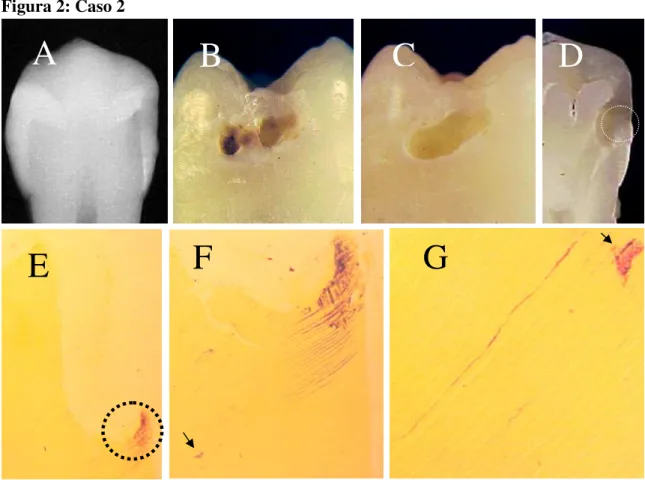 Figura 2: Caso 2 