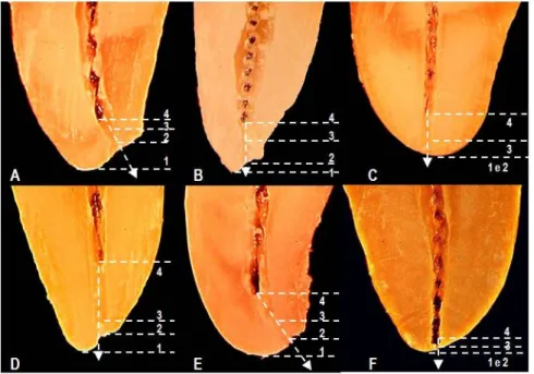 Figura  10.  Região  do  ápice  radicular.  Observar  relação  da  ponta  da  lima  (4)  com  o  ápice  anatômico  (1),  a  saída  do  forame principal (2) e o limite CDC (3)