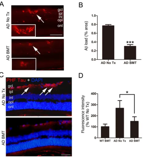 Figure 3. Ab and PHF-tau are reduced in retina of APP swe -PS1DE9 BMT recipient mice. A: Representative photomicrographs of Ab deposition in non-transplanted, age-matched APPswe-PS1DE9 control retina (top, AD No Tx) or APPswe-PS1DE9 that received BMT (bott