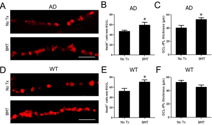 Figure 4. BMT mediates neuroprotection of RGCL neurons in APP swe -PS1DE9 and wt mice