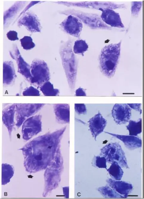 Figura  8  Fotomicrografias  de  fibroblastos  humanos  (HFF)  infectados  com  T. 
