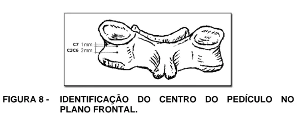 FIGURA 8 -   IDENTIFICAÇÃO  DO CENTRO DO PEDÍCULO NO  PLANO FRONTAL.  
