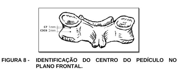 FIGURA 8 -   IDENTIFICAÇÃO  DO CENTRO DO PEDÍCULO NO  PLANO FRONTAL.  