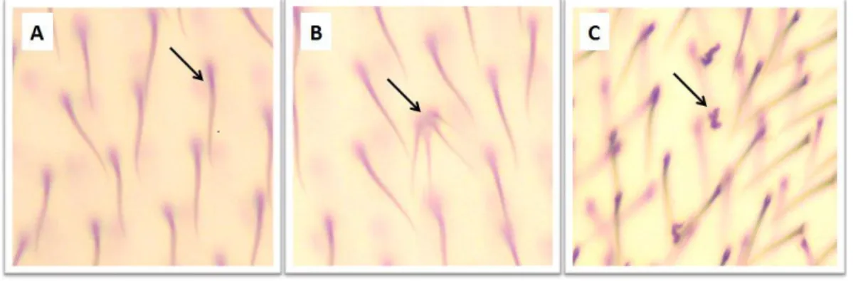 Figura  7.  Fotomicrografias  de  diferentes  fenótipos  de  pelos  de  asas  de  D. 