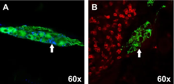 Figura  5:  Avaliação  da  relação  entre  a  expressão  de  serotonina  (azul)  e  a  presença  de  linfócitos  CD8  (vermelho)  no  SNE  (verde)