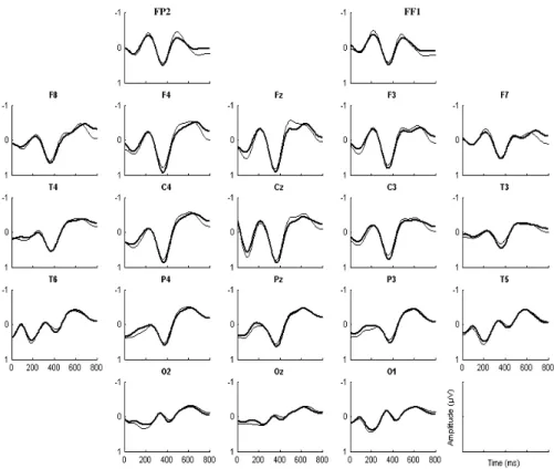 Fig.  16:  Resultados  de  experimento  com  EEG:  ERP  relativo  aos  estímulos  com  a  condição  experimental  e  ERP  segundo  os  estímulos  sem  a  condição  experimental,  ambos  correspondentes a cada derivação (LAGE, 2005, p