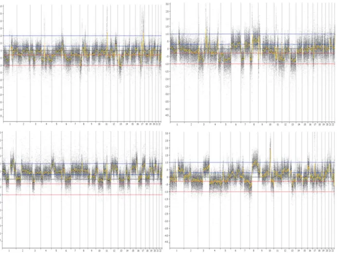 Fig 1. Array-CGH images of CCSS cases displaying “complex-amplifier” genomic profiles