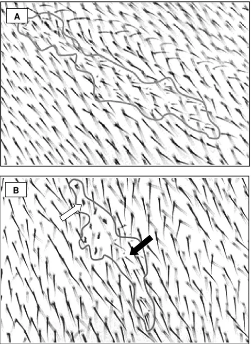 Figura 1.9 – Fotografias de pêlos de asa de  D. melanogaster, ao microscópio  óptico de luz (aumento de 400x), mostrando: A - mancha simples (contornada  pela linha) com pêlos múltiplos (“mwh”) e B - mancha gêmea (contornada pela  linha)  com  pêlos  em  f